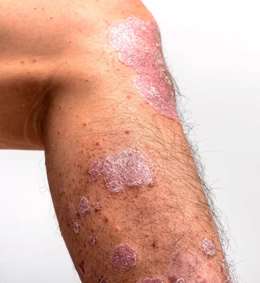 685aa20b3420928fd4e0dbc4